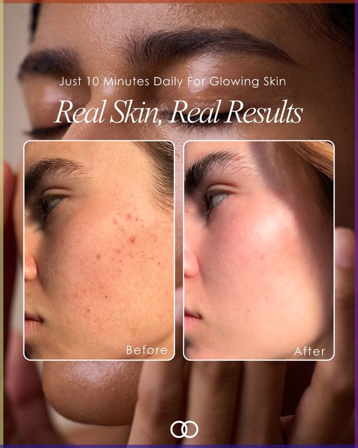 Native Essential Set - 5 Essential Skincare