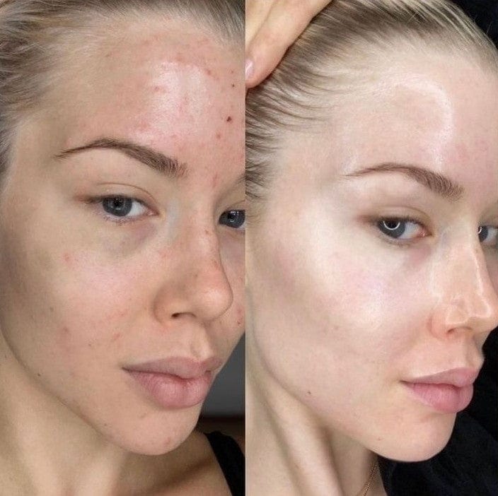 Native Essential Set - 5 Essential Skincare