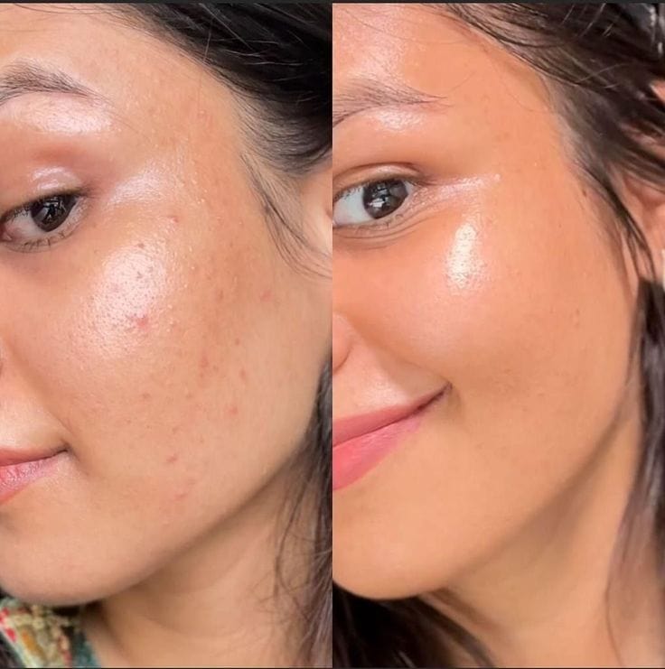 Native Essential Set - 5 Essential Skincare