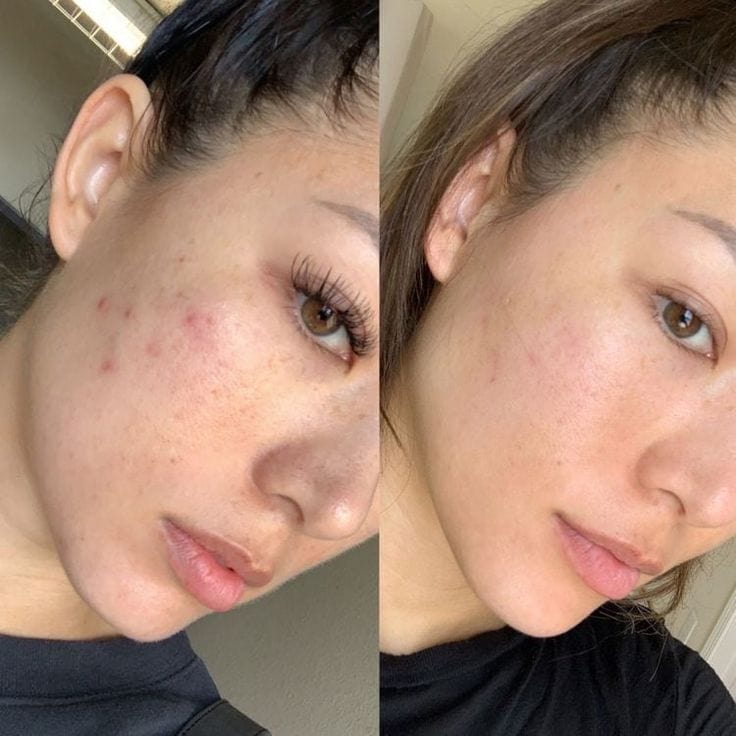 Native Essential Set - 5 Essential Skincare